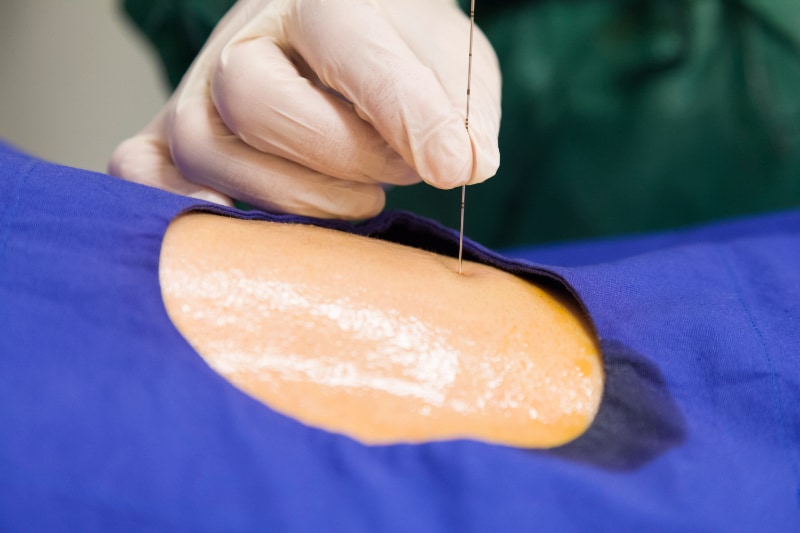 Radiologie KW Königs Wusterhausen Interventionelle Radiologie